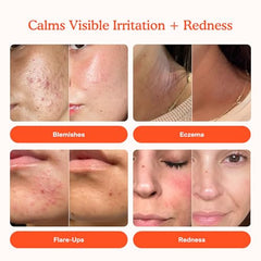 Tower 28 SOS mist application on skin demonstrates calming, barrier-supporting use.