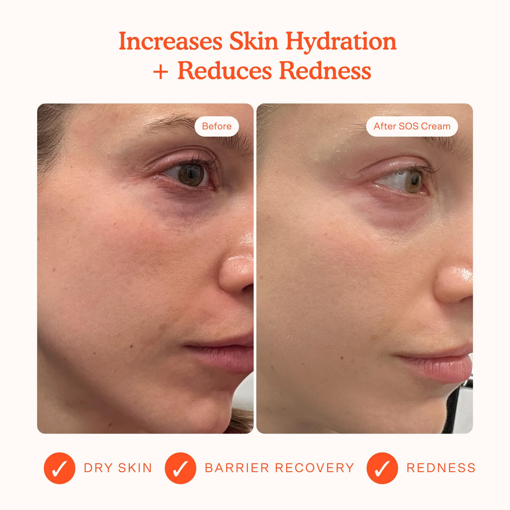 Tower 28 SOS cream application close-up for redness relief and soothing care.