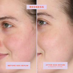 Tower 28 SOS Intensive Rescue Serum texture-sheer showcases lightweight hydration on irritated skin