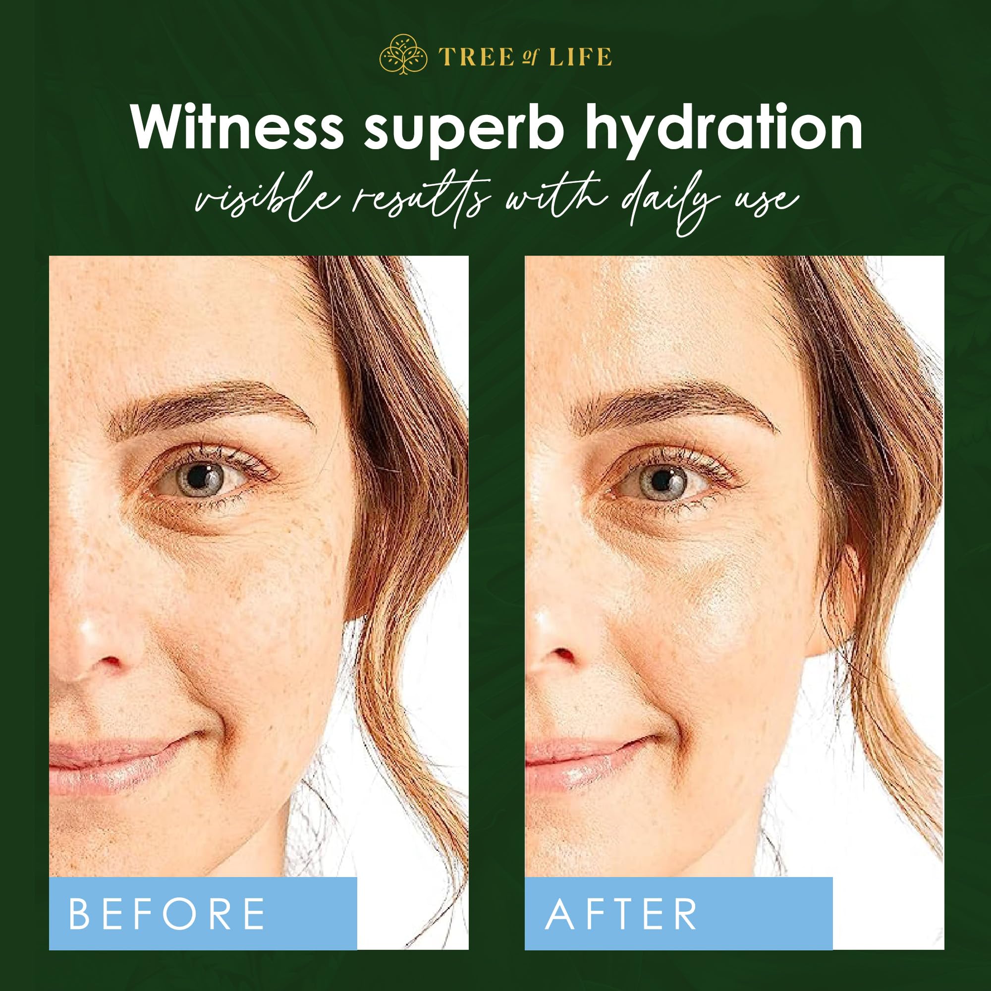 Tree of Life Beauty Hyaluronic Acid Serum application on face demonstrating even distribution