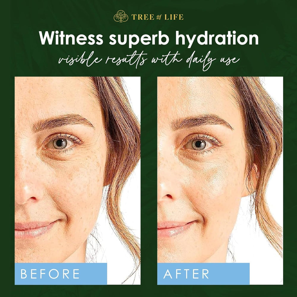 Tree of Life Beauty serum on skin showing even appearance