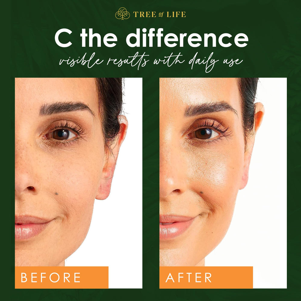 Tree of Life Beauty Vitamin C Set for daily routine boosts radiance.