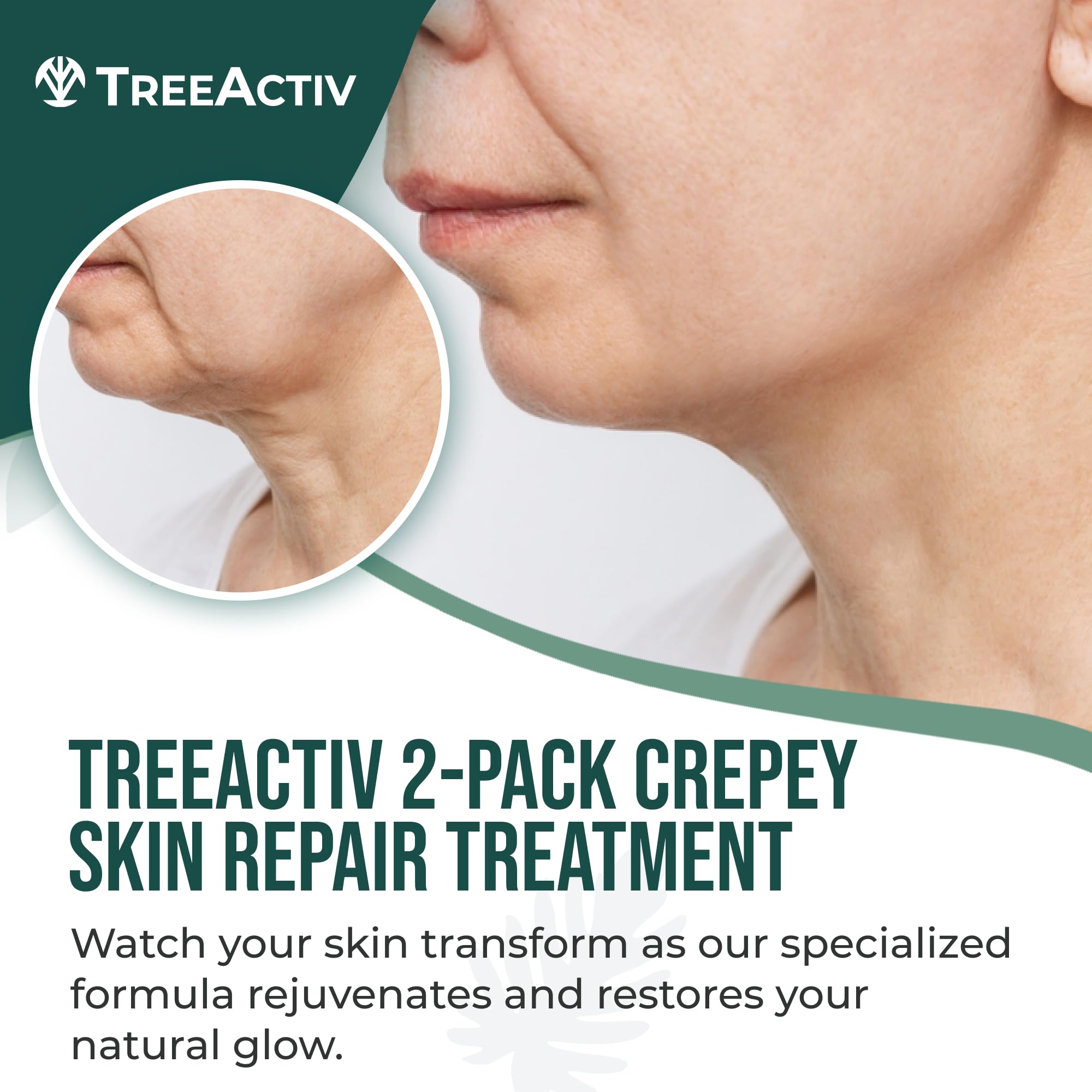 TreeActiv Crepey Skin Repair Cream dispenser for easy application