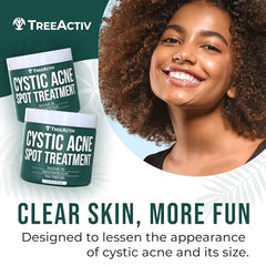TreeActiv cystic acne spot-treatment bentonite-clay ingredients highlight drawing out impurities.