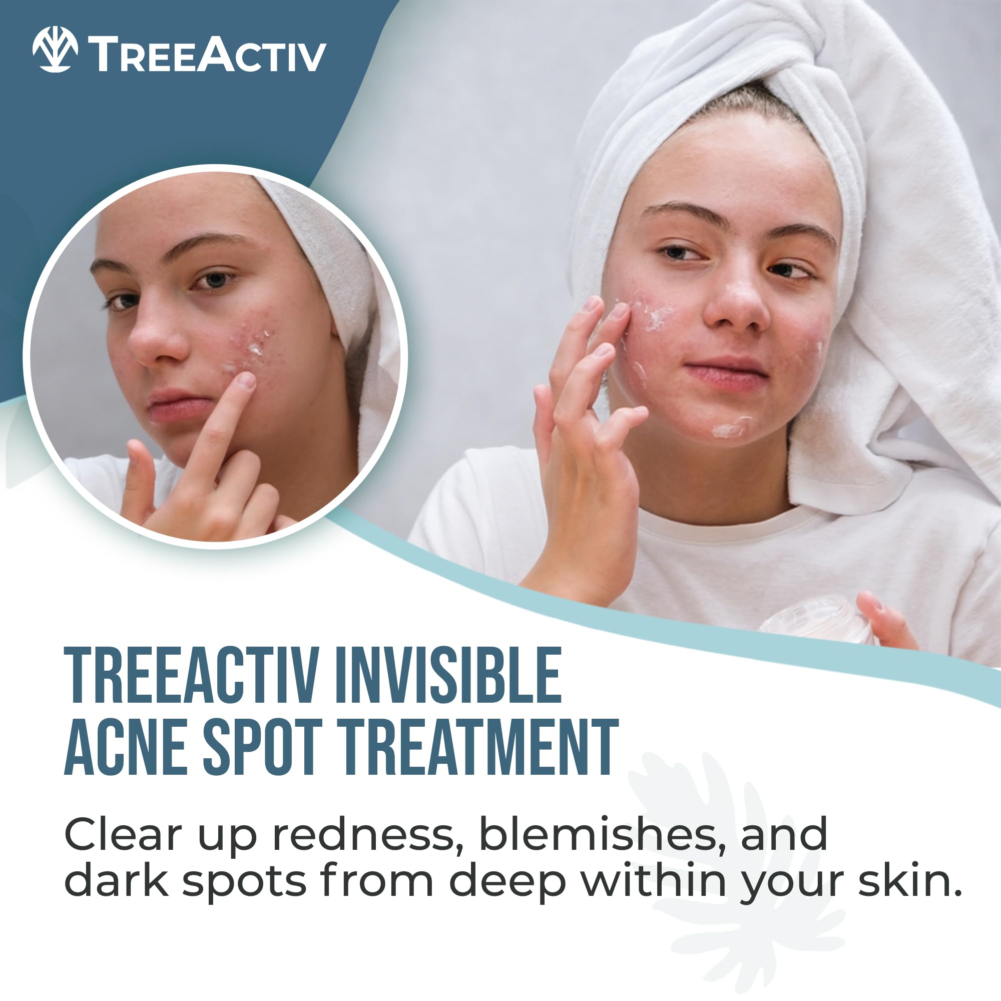 TreeActiv Invisible Acne Spot Cream dispense shows targeted application for red bumps and pores.