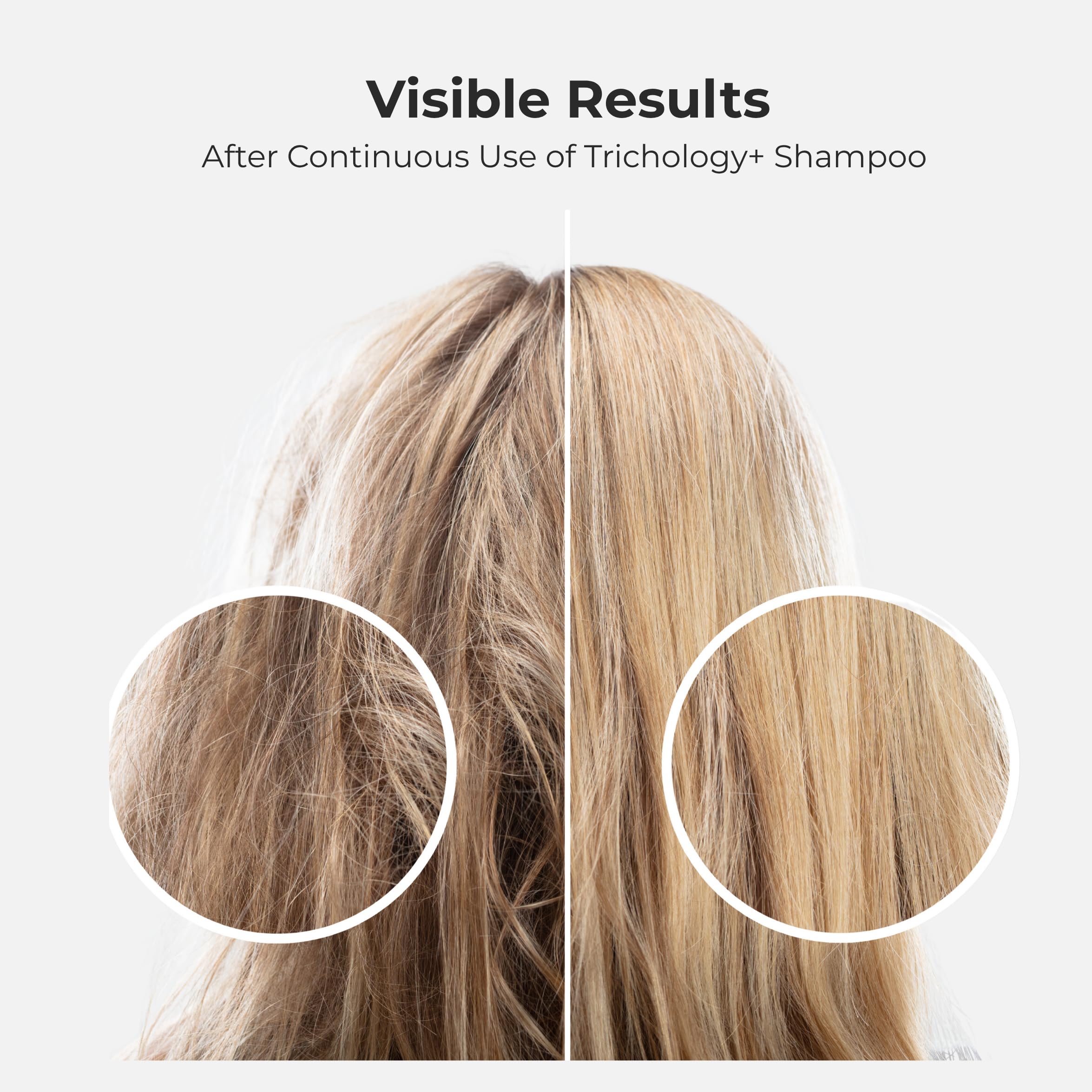 Tricholoy+ airy-lather closeup illustrates lightweight cleansing and easy rinse.