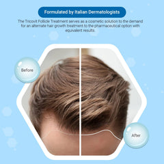 Tricovit Forte ampoules pack close-up highlighting treatment for hair growth.