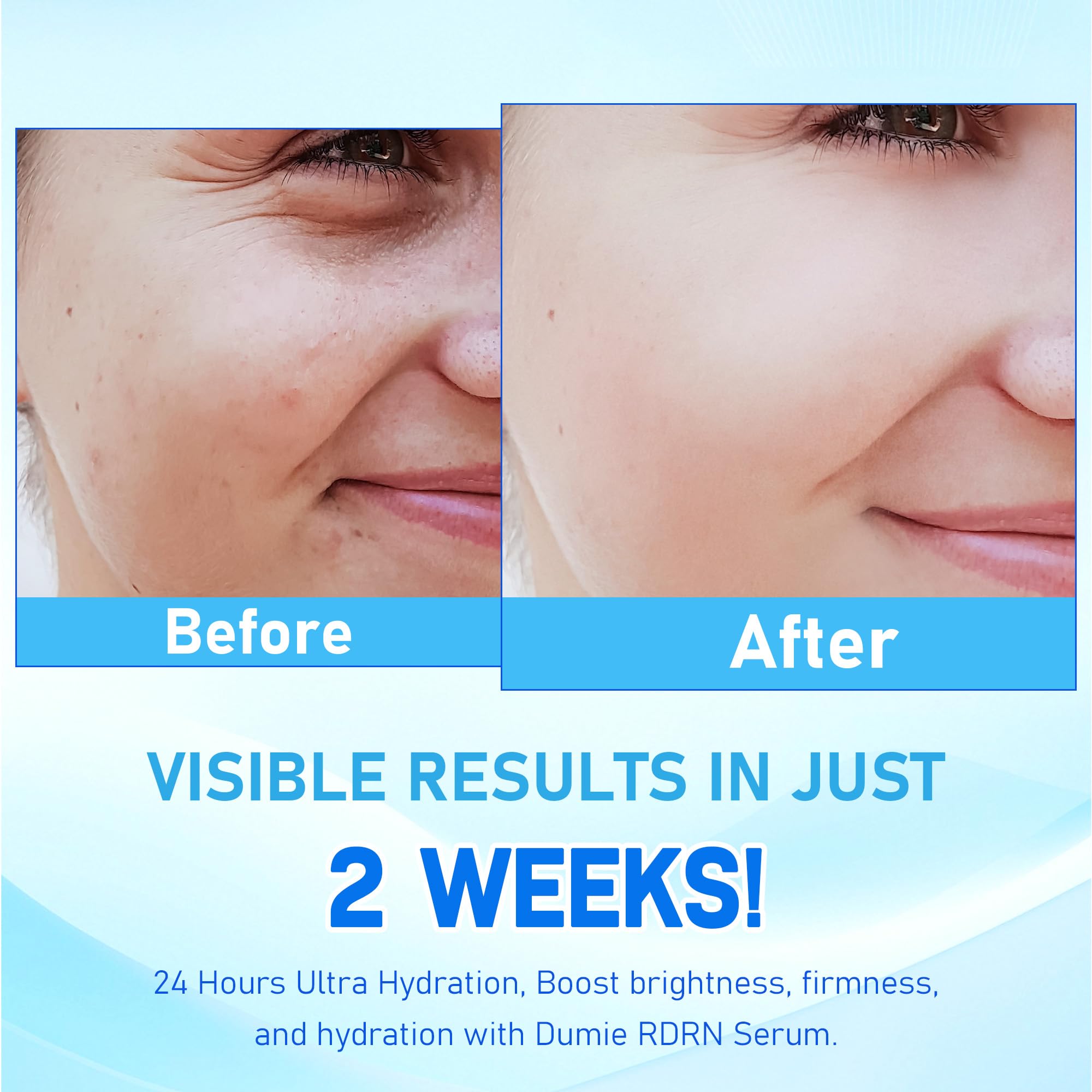 Panthenol, Betaine, Ethylhexylglycerin reinforce moisture barrier and comfort