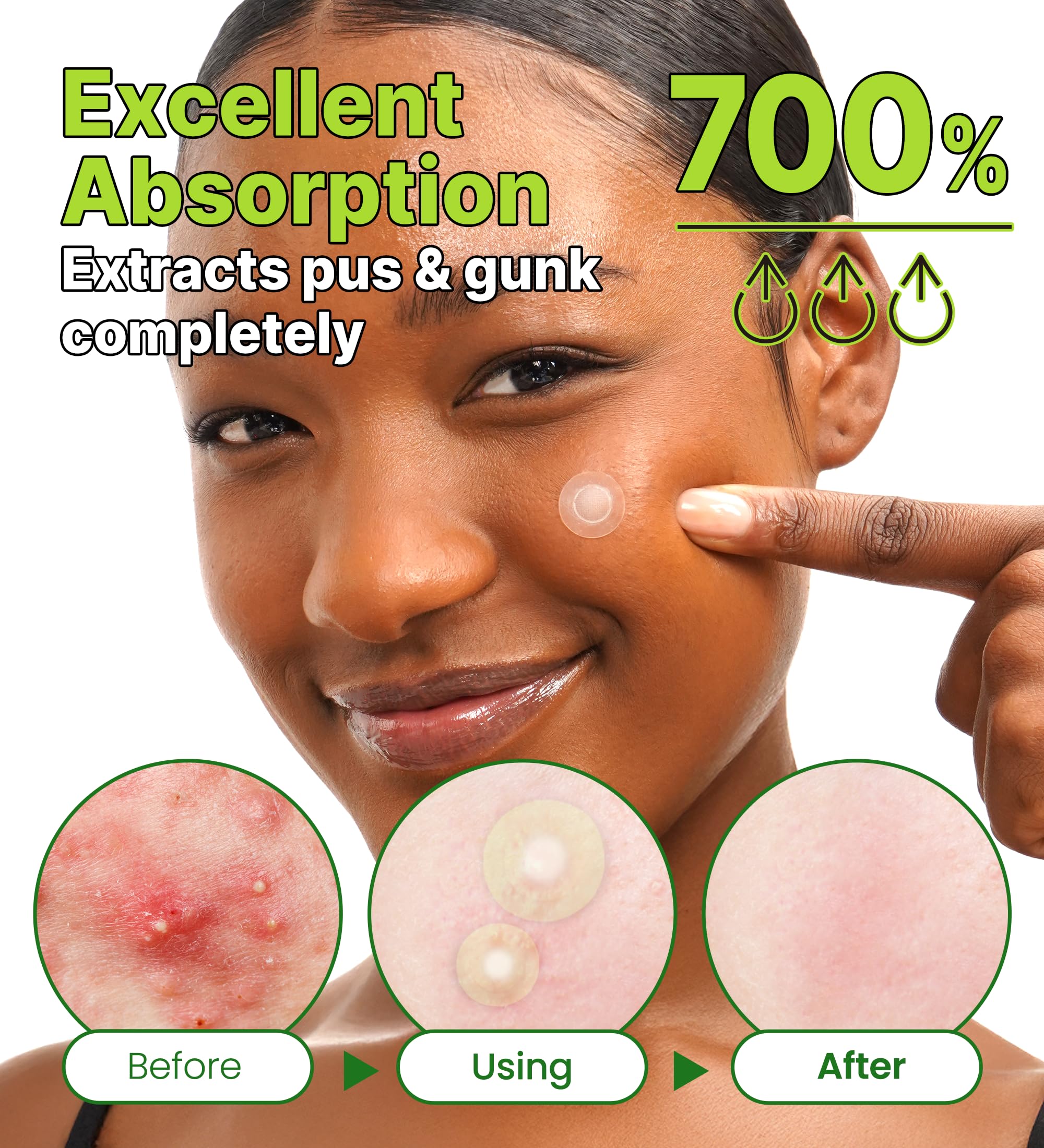 Troubless Invisible+ Spot Patch Red Correct dispensing card demonstrates easy, quick application