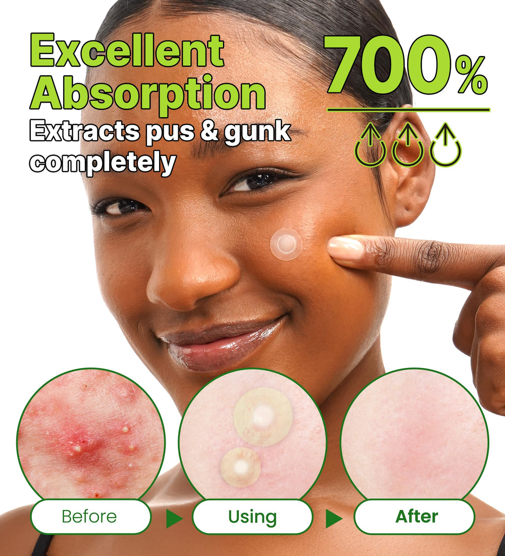 Troubless Invisible+ Spot Patch Red Correct dispensing card demonstrates easy, quick application