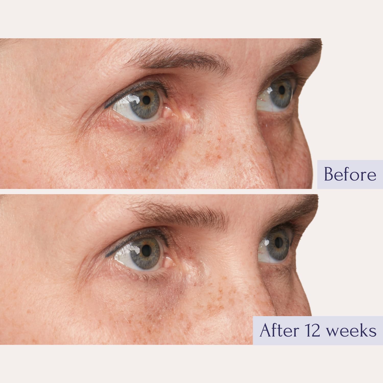 Tru Alchemy Eye Elixir bottle and applicator in use close-up