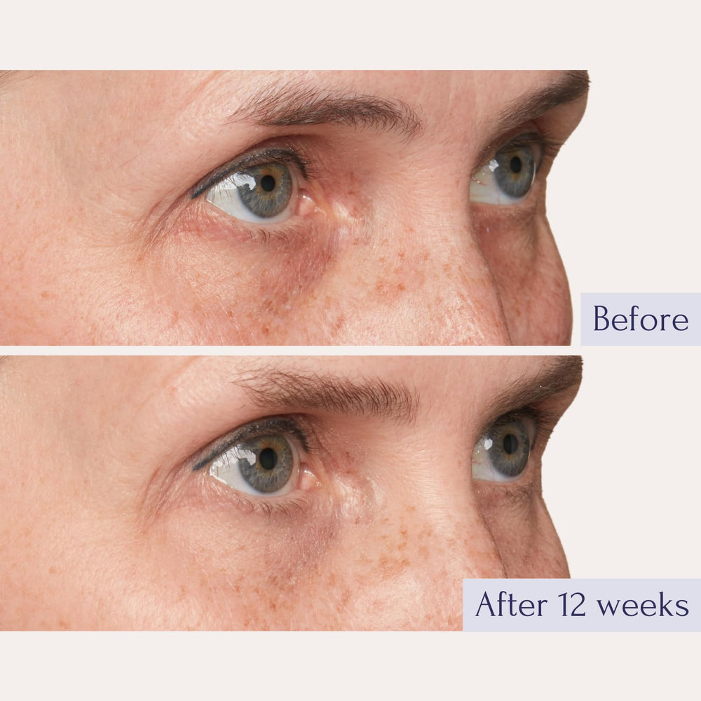 Tru Alchemy Eye Elixir bottle and applicator in use close-up