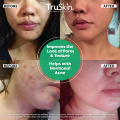TruSkin serum application steps on clean skin for routine use