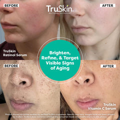 TruSkin serum drops on hand illustrate easy, precise application.