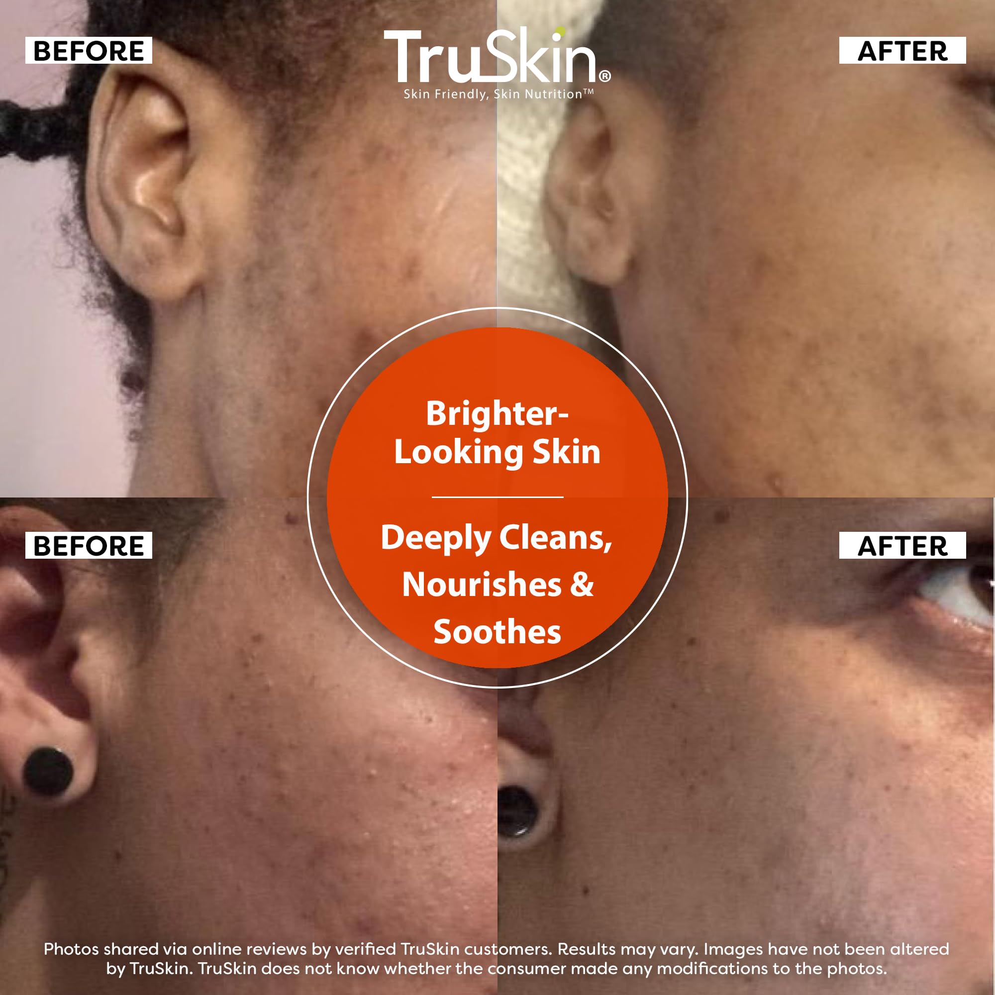 TruSkin MSM delivery focus illustrates actives penetrating for healthy-looking complexion.