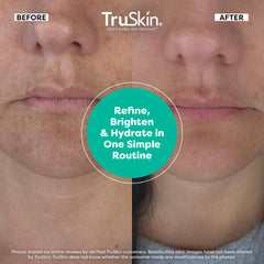 TruSkin Vitamin C Serum bottle emphasizes antioxidant boost for even tone.