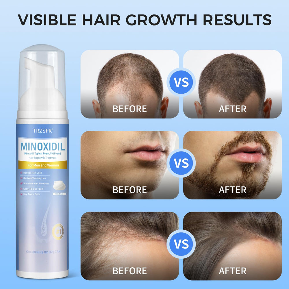 Trzsfr minoxidil foam closeup texture indicating fast absorption