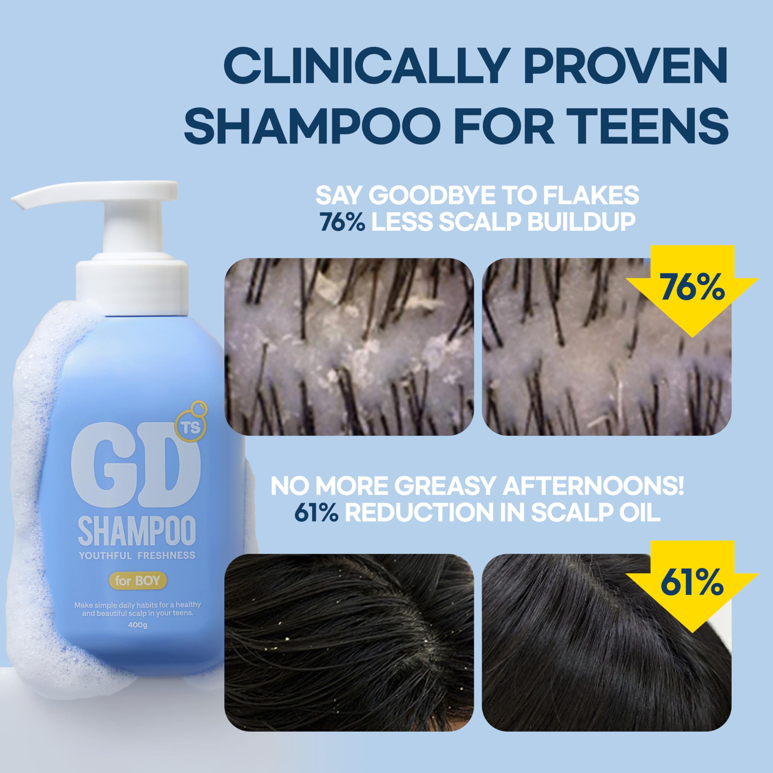 TS GD Shampoo dandruff close-up emphasizes oil balance and freshness.