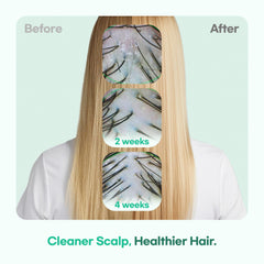TS GD Shampoo container highlights dandruff odor and itch control for daily comfort.