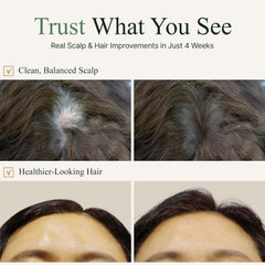 TS Gold Plus Shampoo biotin and niacinamide ingredients illustrate nourishing scalp balance.