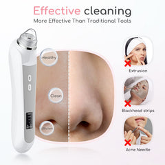 TTozka Blackhead Remover kit includes six heads for varied skin needs.