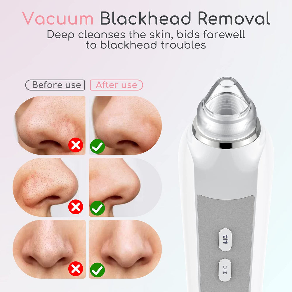 TTozka Blackhead Remover stainless steel tools bundle complements routine pore care.
