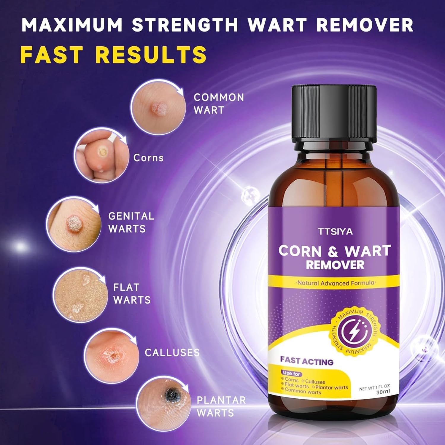 TTsiya Wart Remover Cream applying-on-wart demonstrates easy daily care
