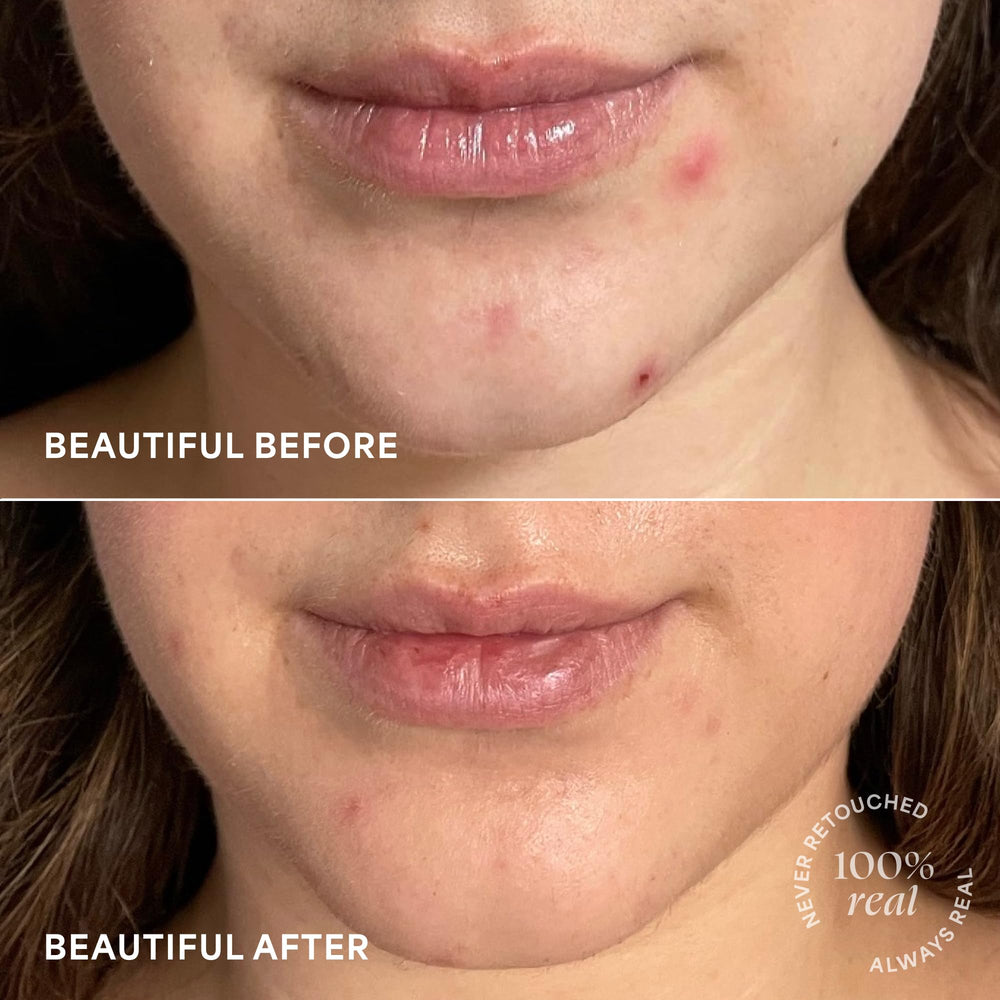 TULA Brightening Treatment Drops close-up texture emphasizes lightweight serum finish.