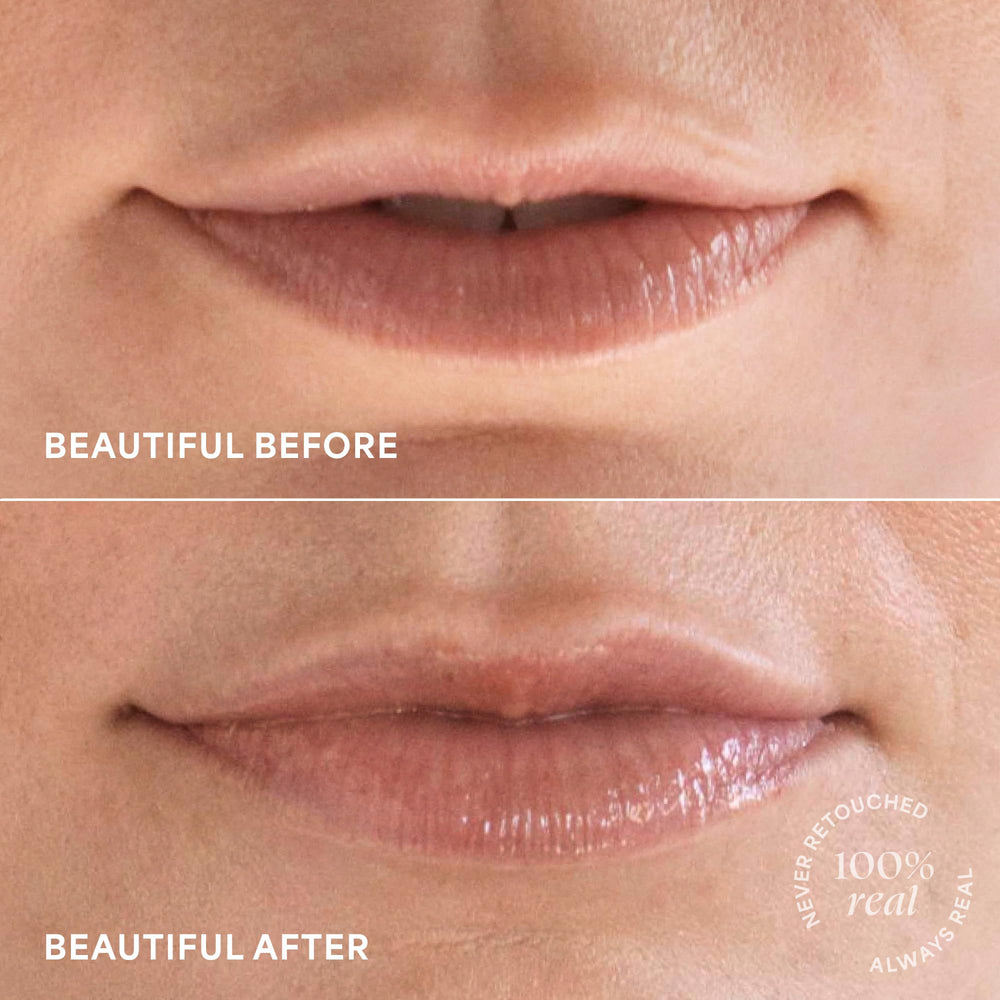 TULA peptides-maple-lip-closeup demonstrates peptide-powered pout enhancement.