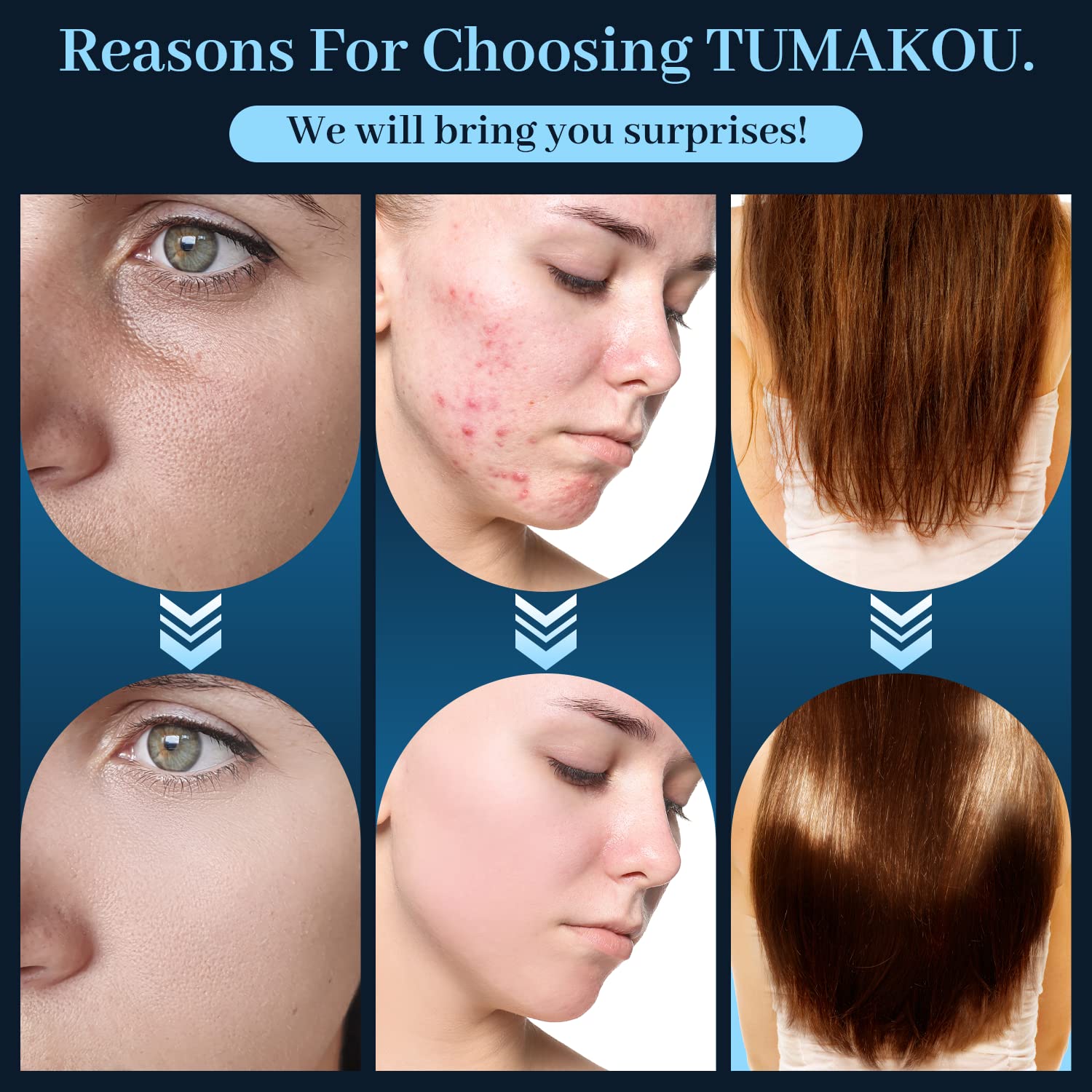 TUMAKOU blue tongue tube for eye-area comfort.