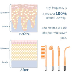 TUMAKOU mushroom glass tube for targeted facial area treatment