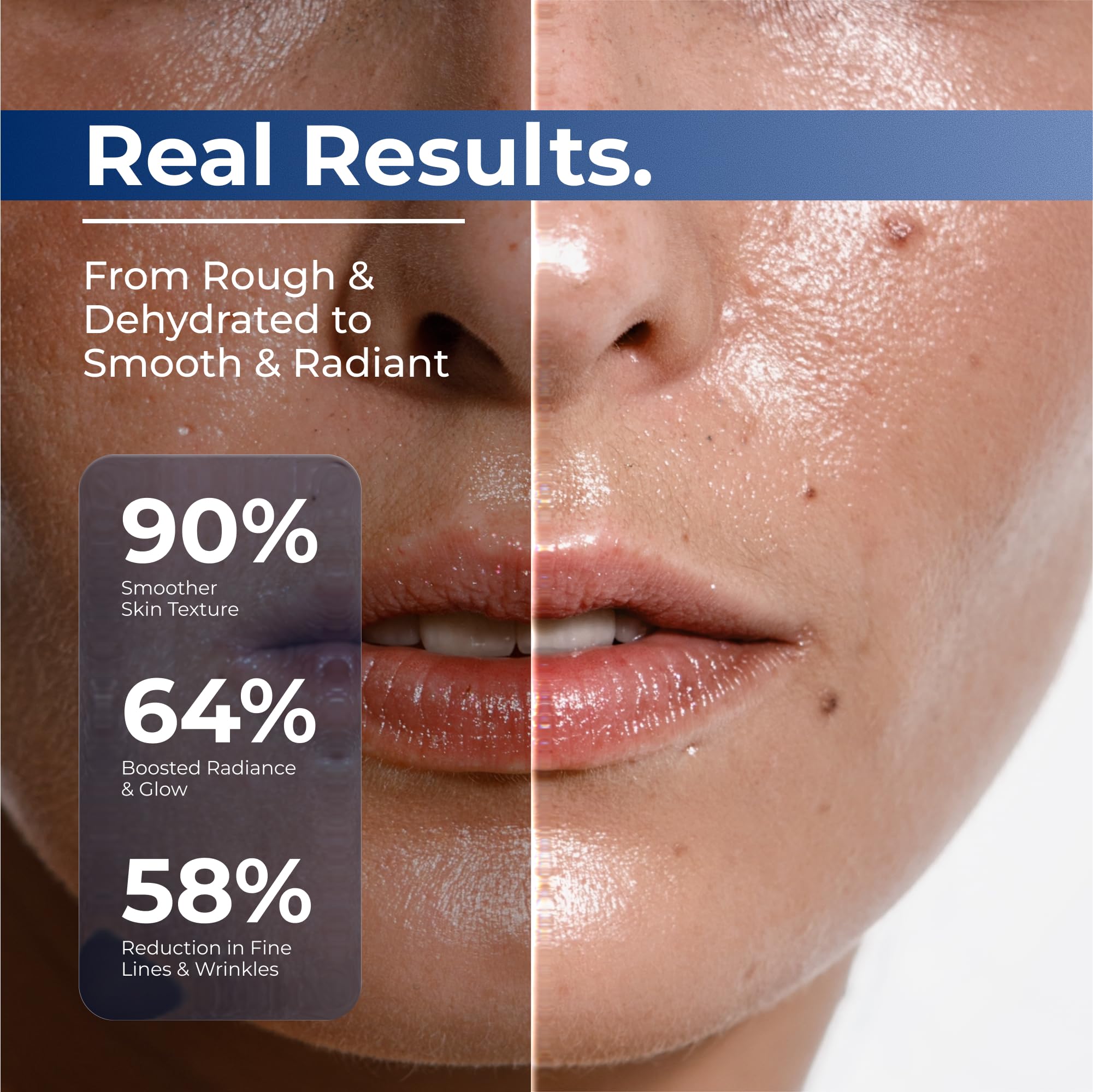 Turmskin Hyaluronic Serum application on skin demonstrates smooth, hydrated texture