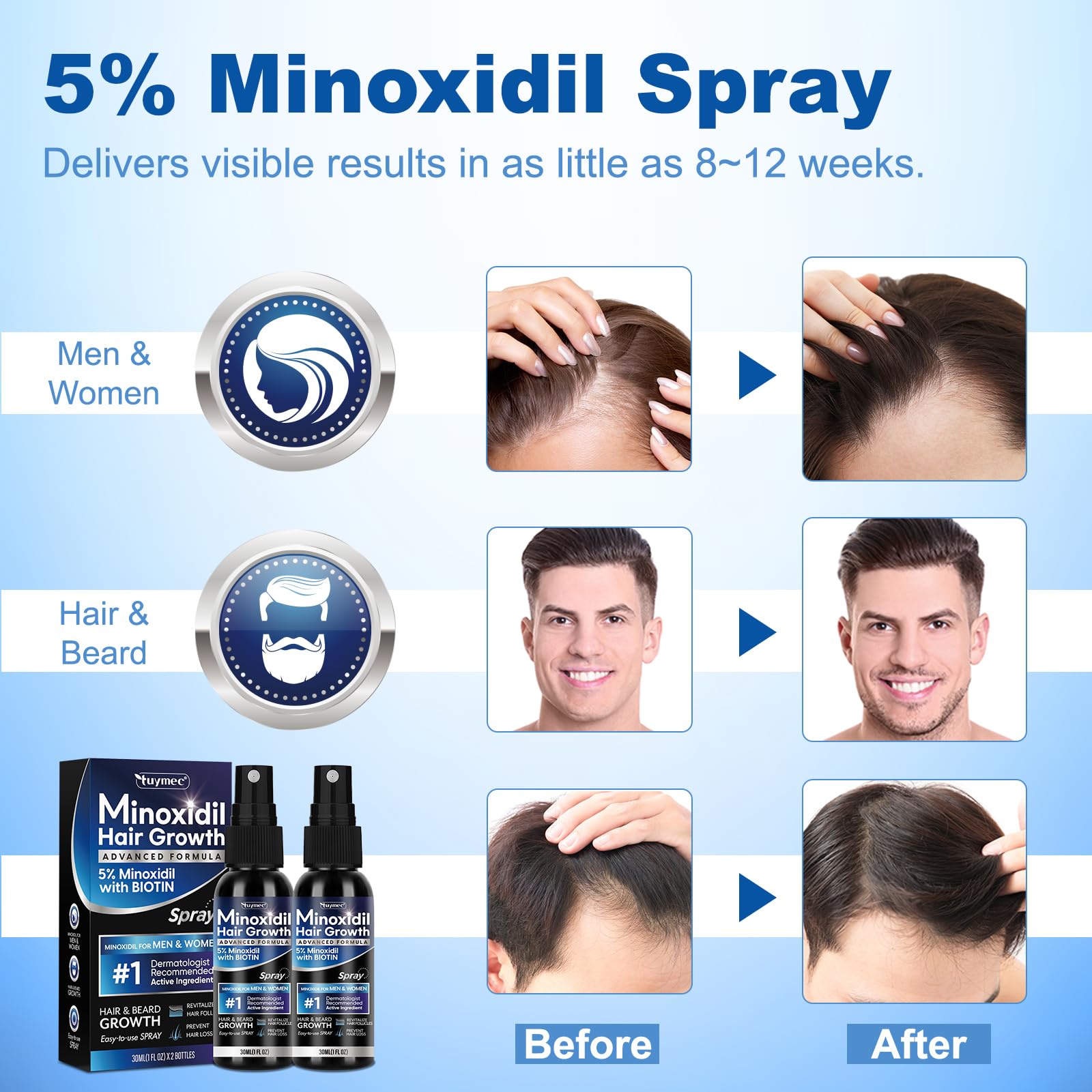 Tuymec Minoxidil 2-pack on display for convenient use.
