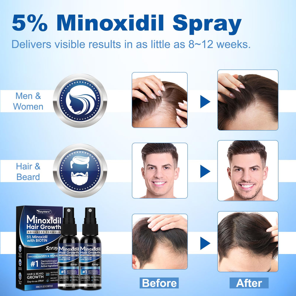 Tuymec Minoxidil 2-pack on display for convenient use.