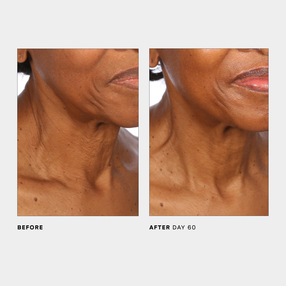 U Beauty SCULPT immediate results concept image hints at firmness and hydration improvements.