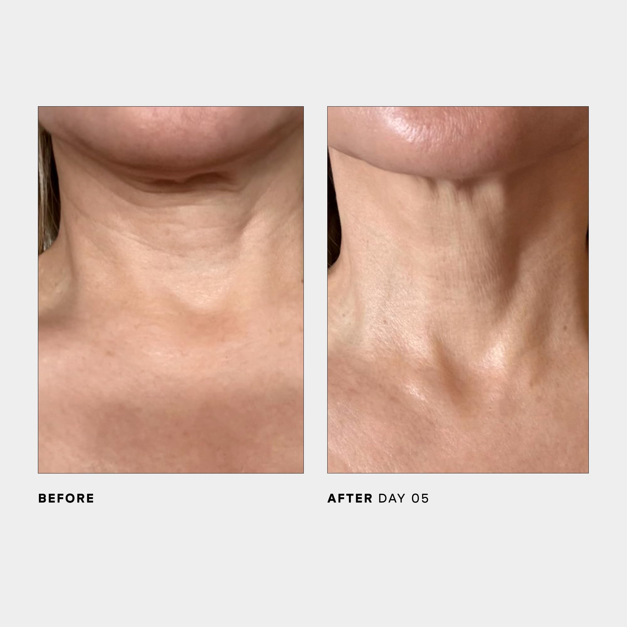 U Beauty SCULPT neck and jawline massage shot demonstrates lifting and contouring potential.