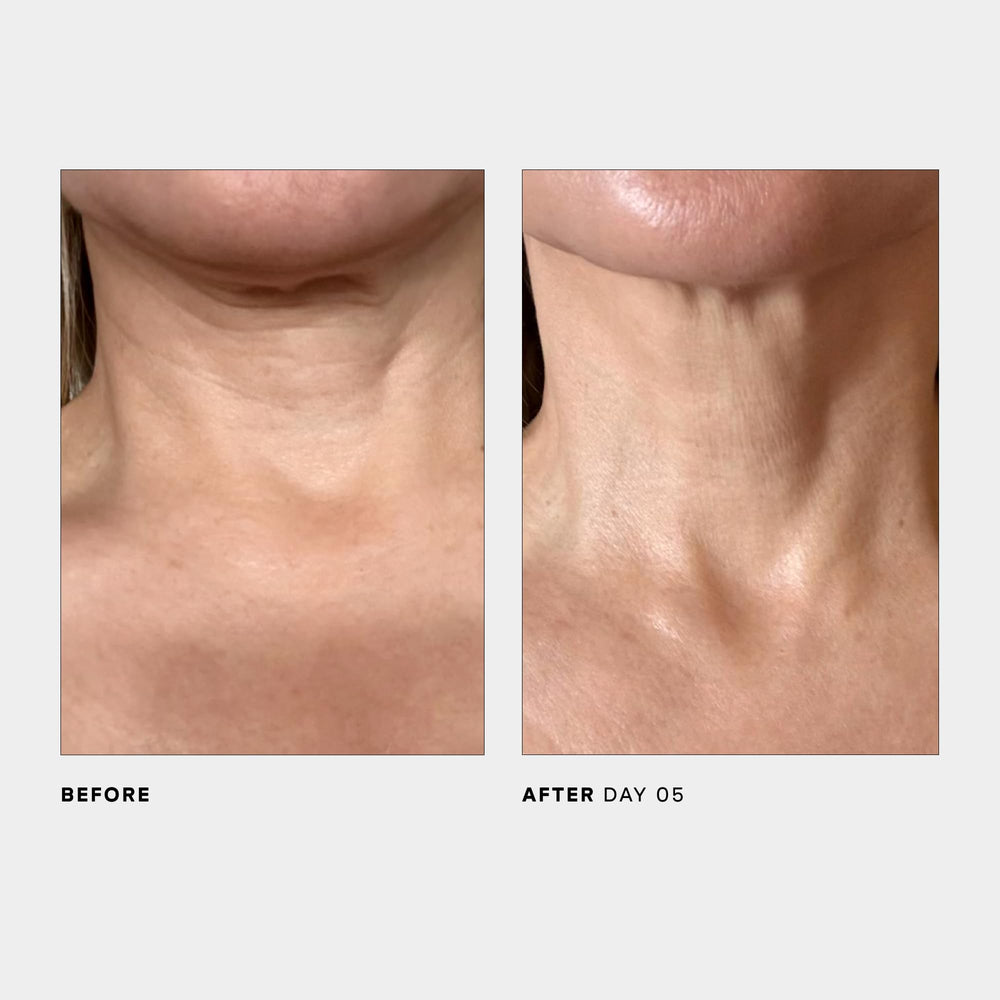 U Beauty SCULPT neck and jawline massage shot demonstrates lifting and contouring potential.