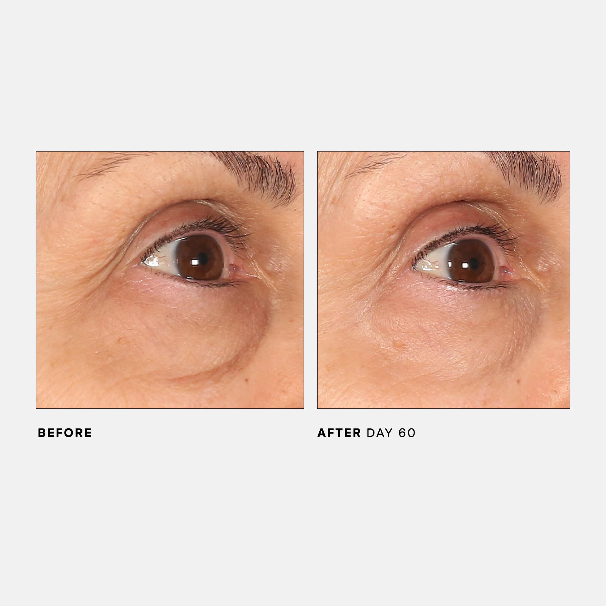 U Beauty The RETURN Eye Concentrate bottle display signals antioxidant rich formula for daily care
