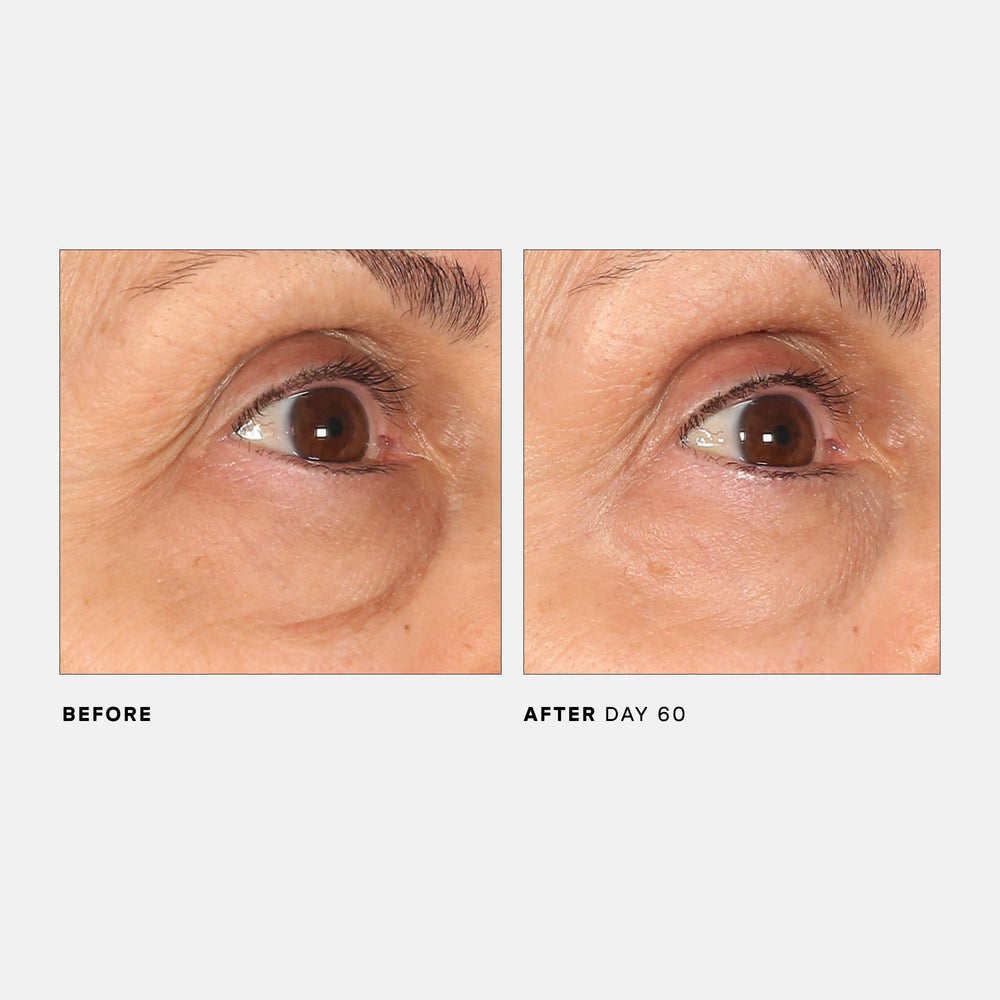 U Beauty The RETURN Eye Concentrate bottle display signals antioxidant rich formula for daily care