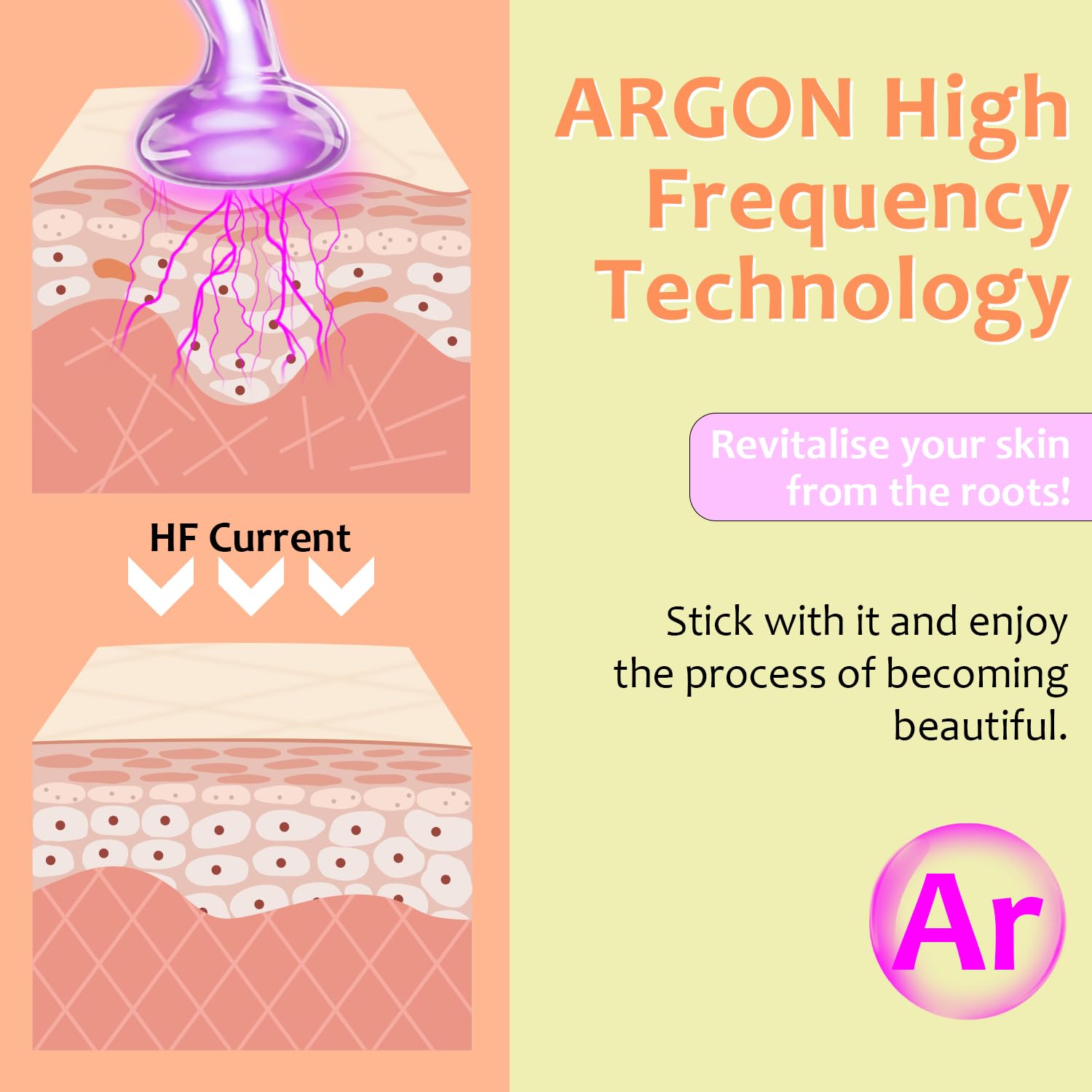 Uaike tongue-tube attachment for precise, gentle application