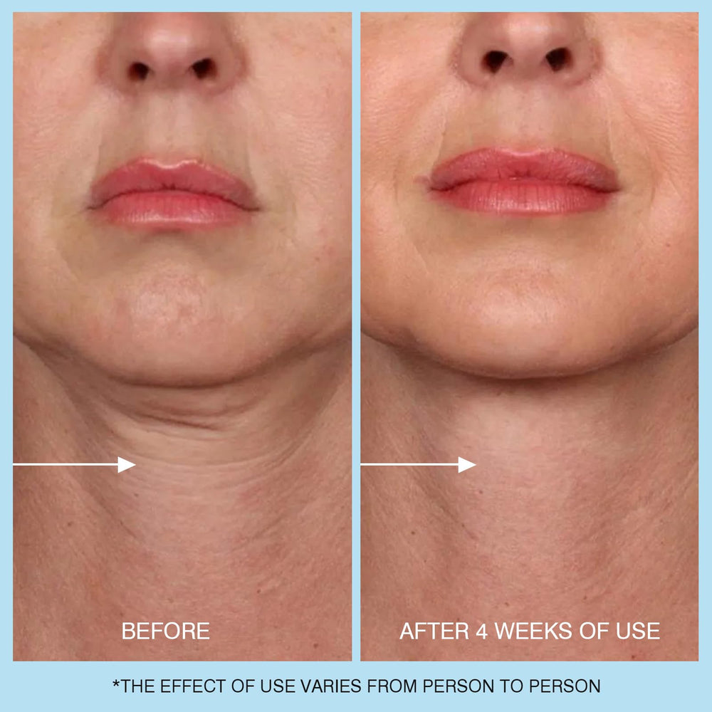 UJHAY Retinol Neck Cream with caffeine for morning energy boost