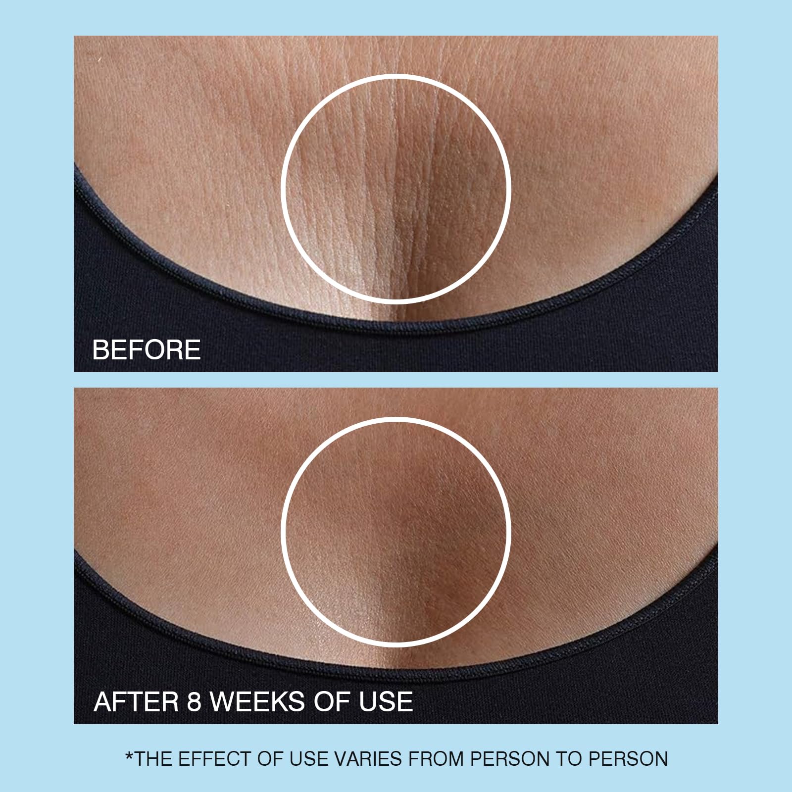 UJHAY Retinol Neck Cream rich texture signals luxury skincare