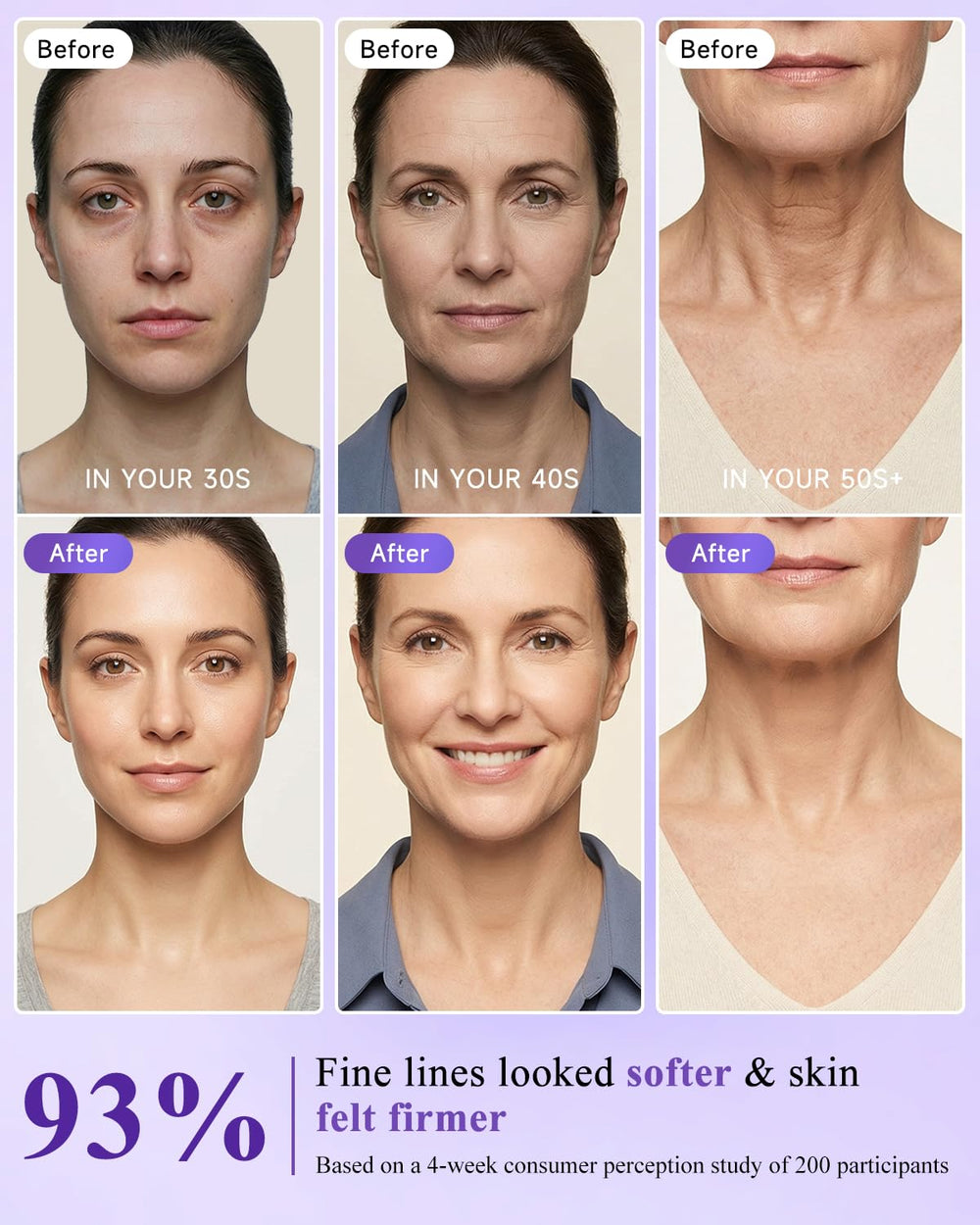 UKVOA Collagen anti-aging lift demonstrating plump, revitalized skin texture.