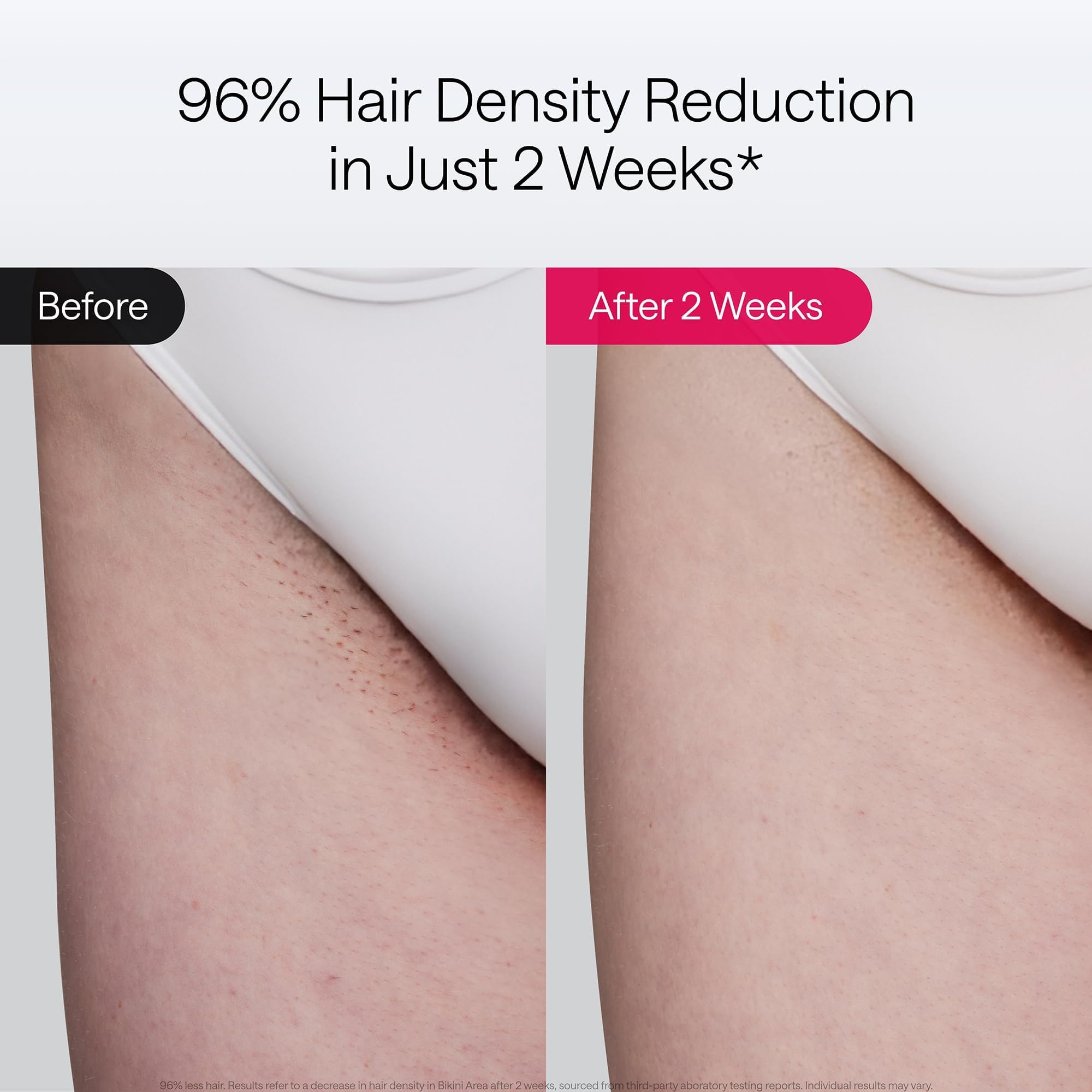 Ulike Air 10 SkinSensor detects skin tone for safe use