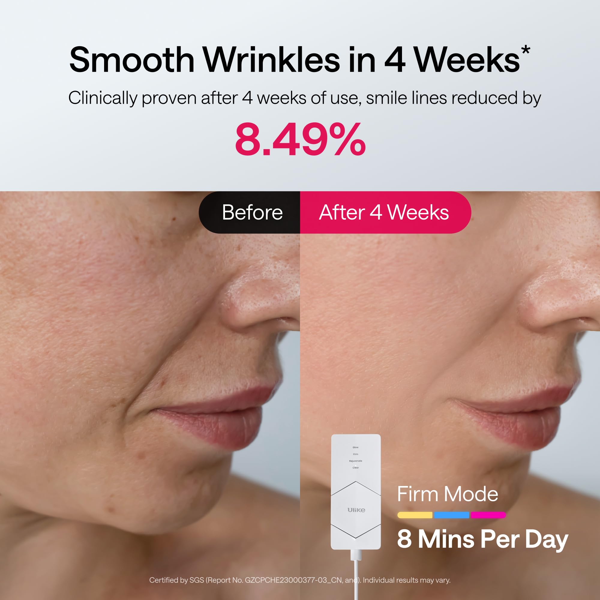 Ulike ReGlow mask 360-degree coverage delivers comprehensive facial treatment