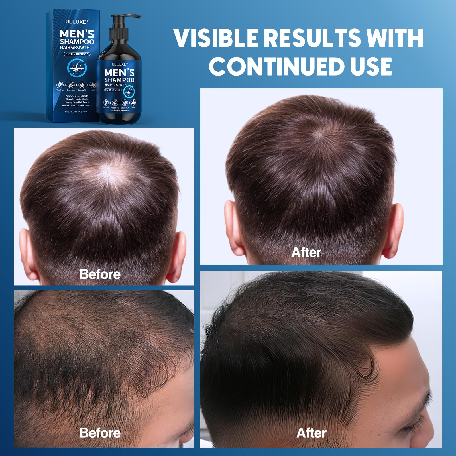 ulluxe biotin hair growth shampoo ingredients castor oil close-up.