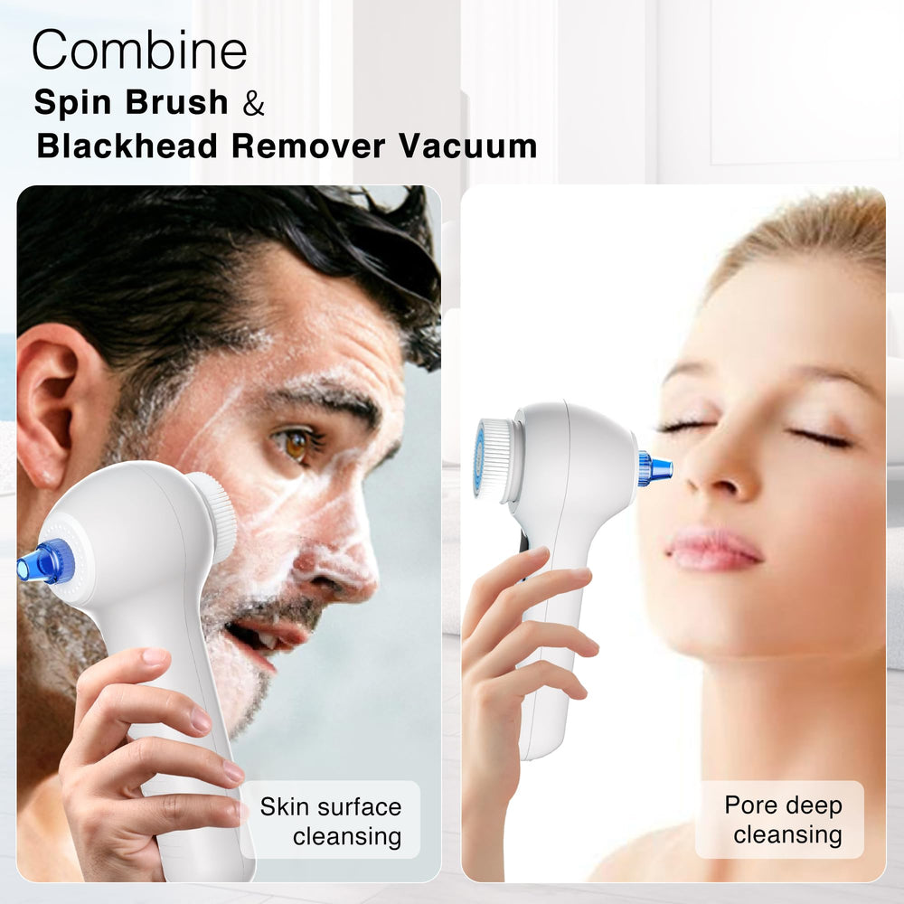 Umickoo blackhead vacuum remover with adjustable suction for pore cleaning.