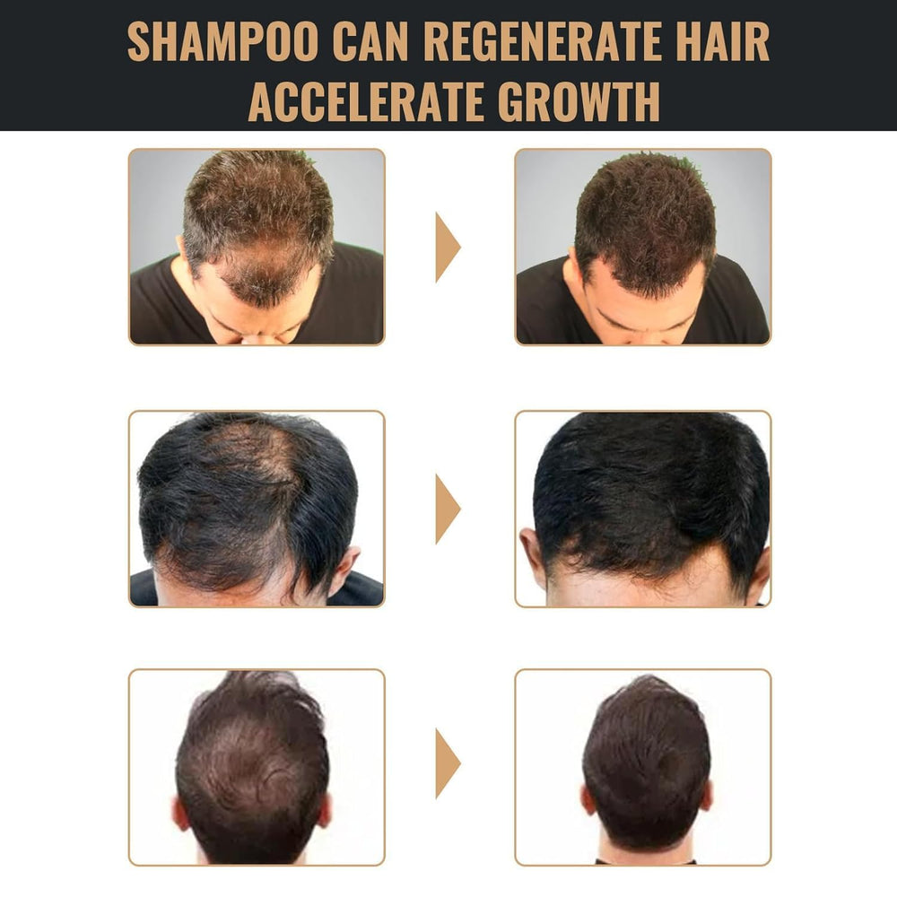 UN UNITEDTIME Root Activator Shampoo natural-ingredients close-up signals gentle, natural care.