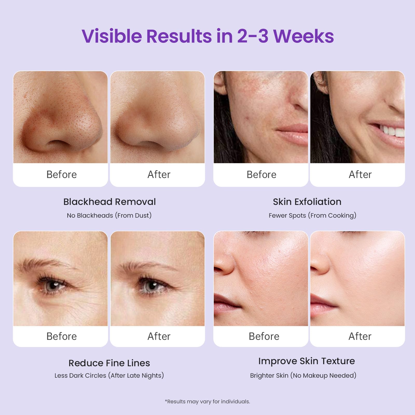 UNOISETION Home-use scene illustrates quick 15-minute skincare sessions.