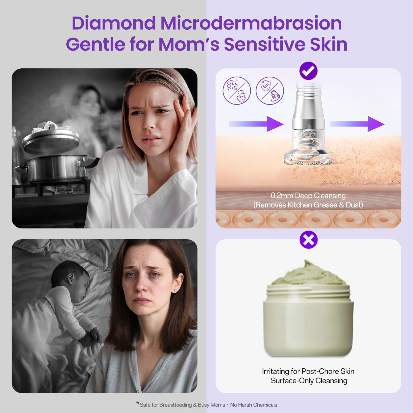 UNOISETION Diamond Microdermabrasion Machine kit included shows complete home-use setup.
